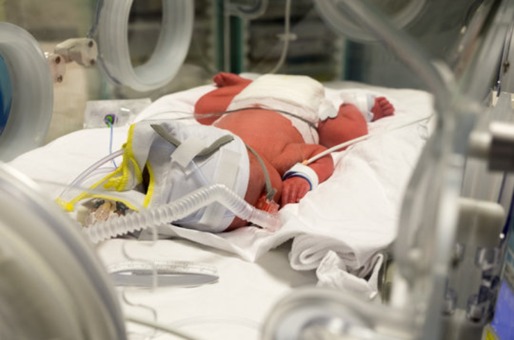 Neonatal Intensive Care (Level 3)------0